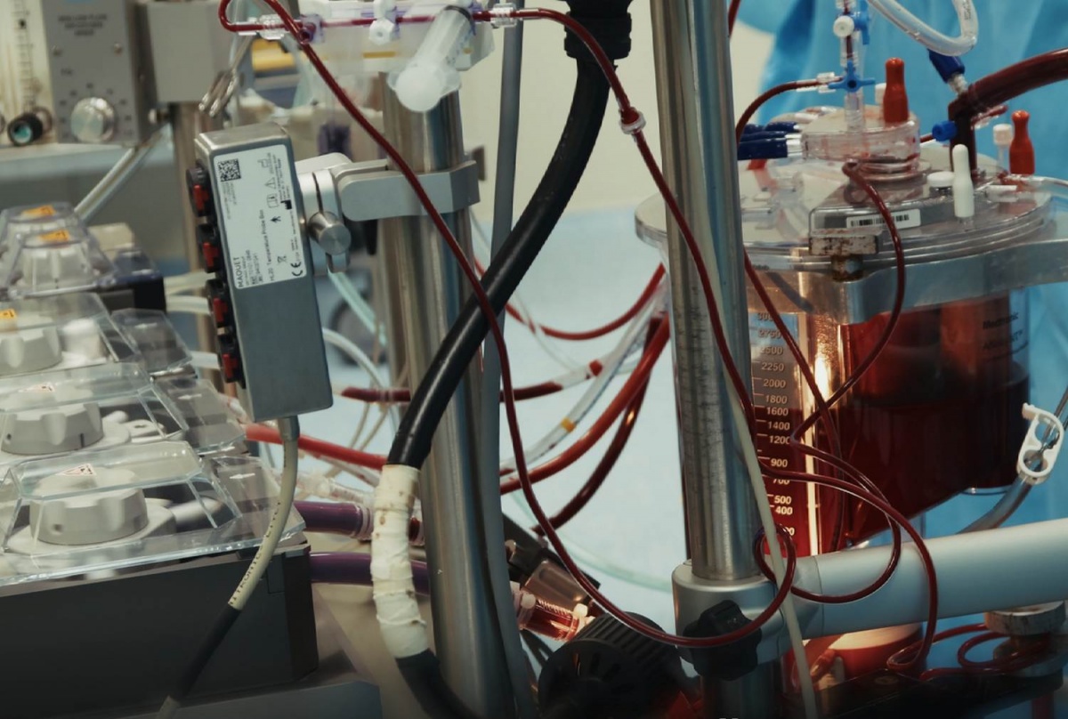 Четверо нижегородцев чуть не умерли от разрыва аорты: их спасли врачи - фото 1