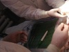 Уникальную операцию по удалению почки провели нижегородские врачи