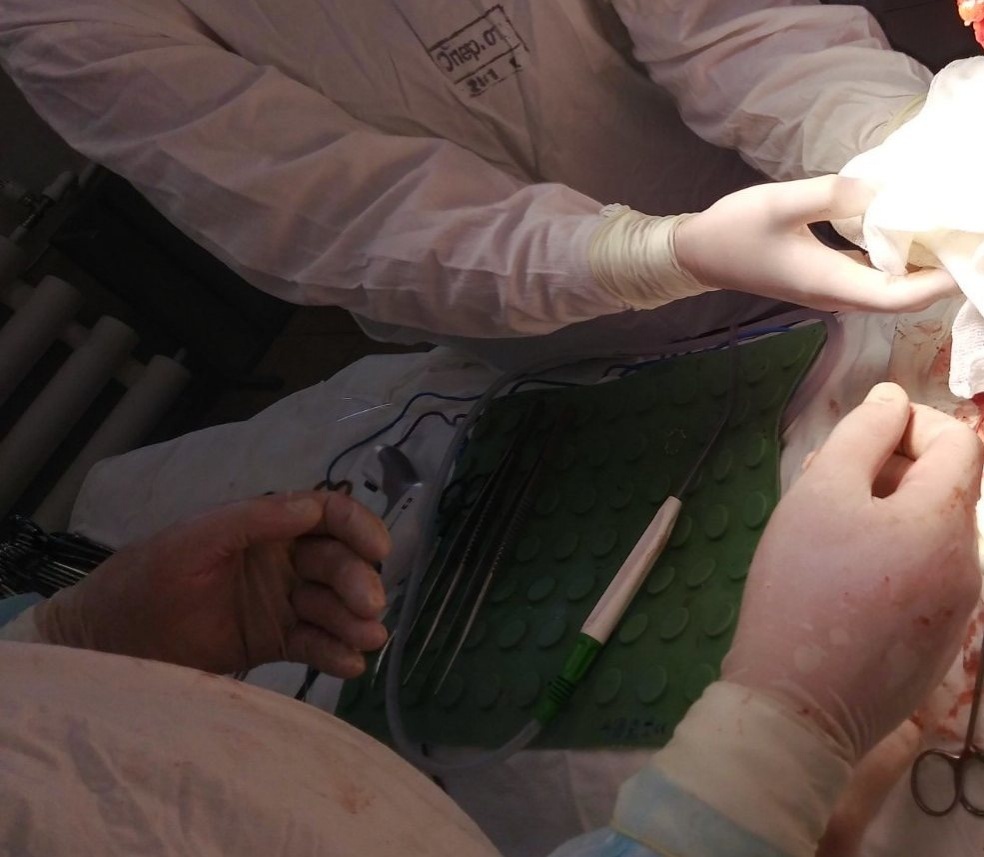 Уникальную операцию по удалению почки провели нижегородские врачи - фото 1