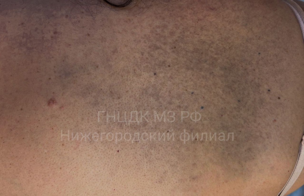 Редчайшую жуткую патологию выявили у нижегородки - фото 1